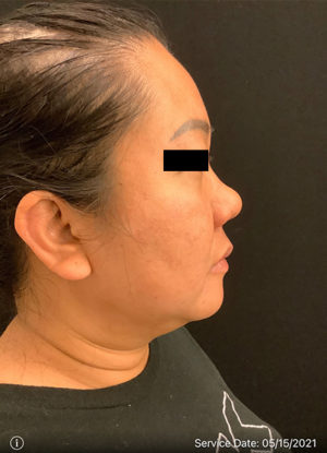 Medispa/Nonsurgical